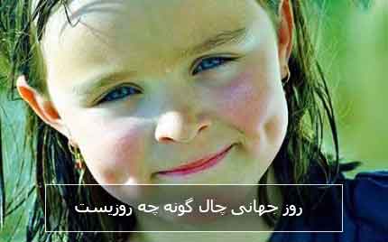 روز جهانی چال گونه چه روزیست